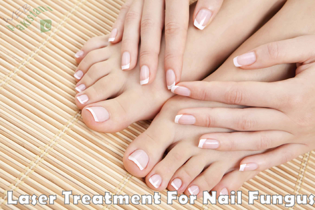 Laser Treatment For Nail Fungus