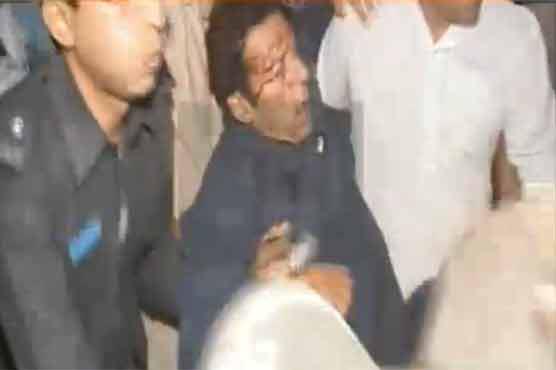Head Injury to Imran Khan