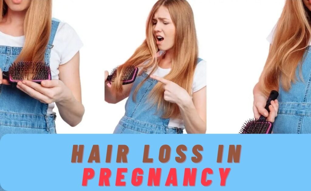 Hair Loss in Pregnancy